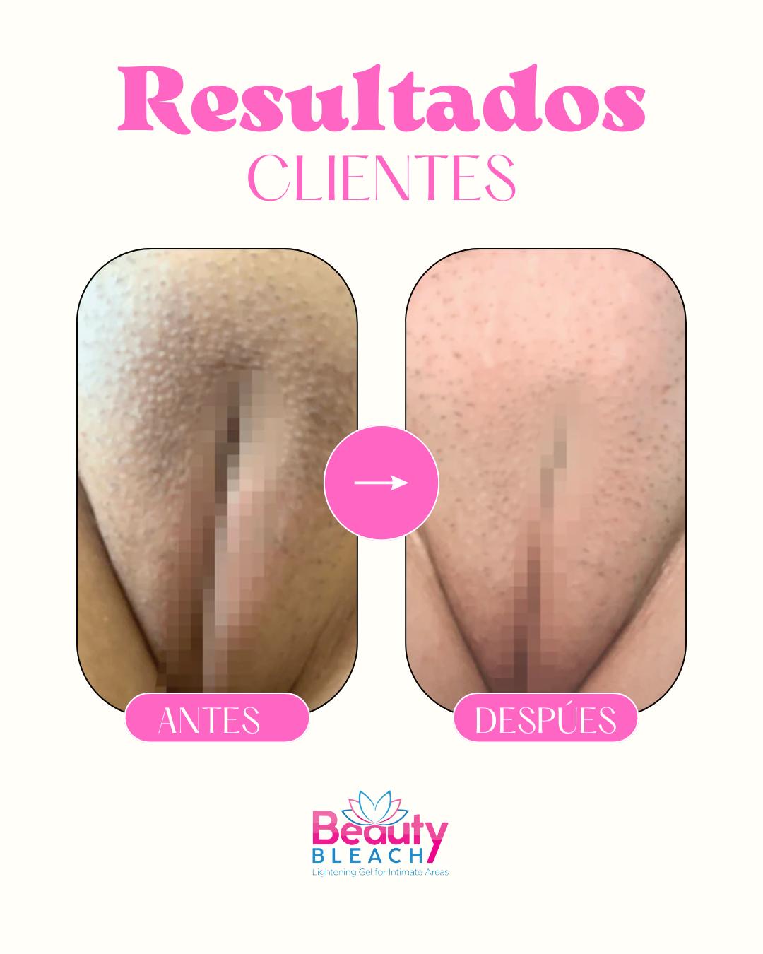 BeautyBleach