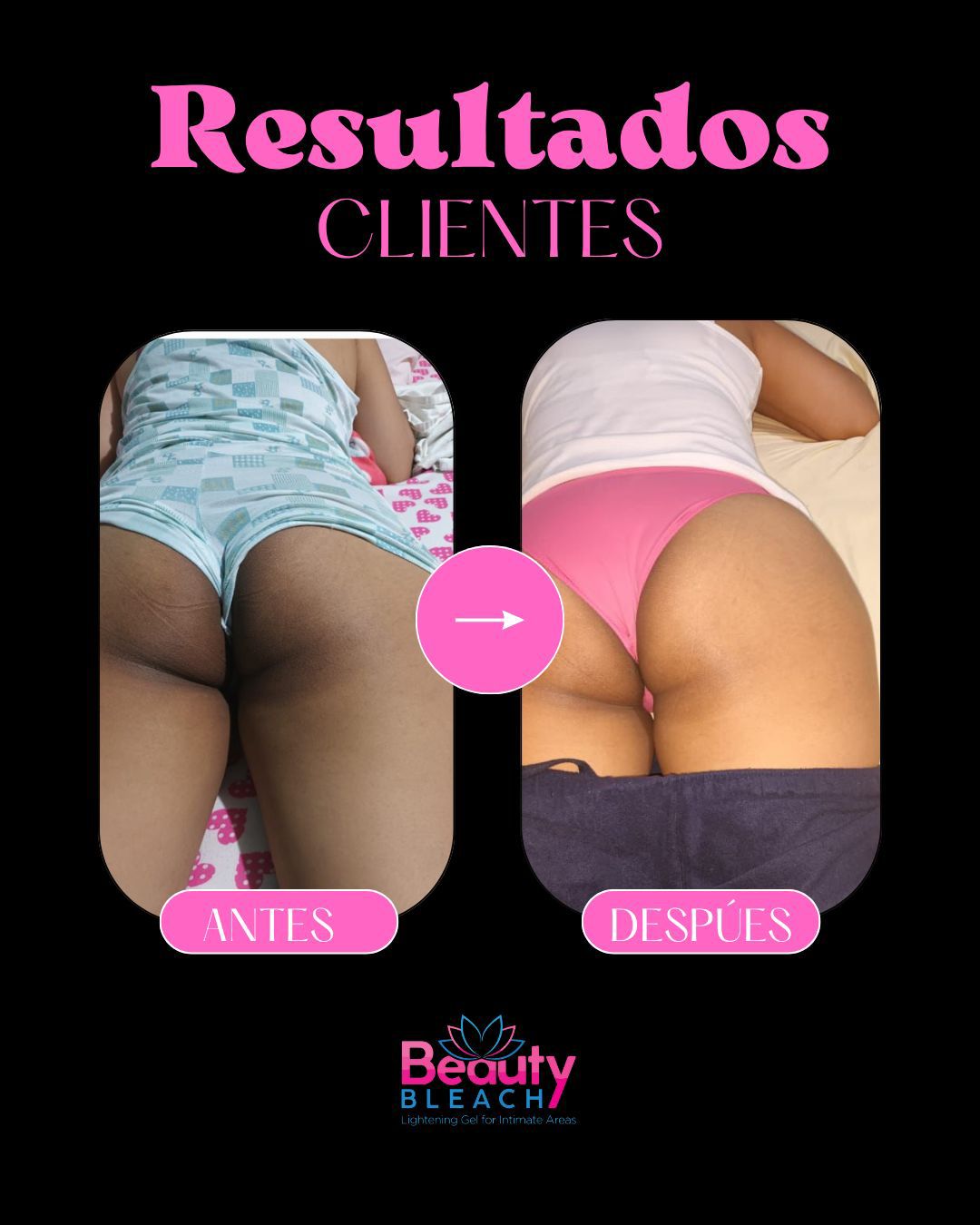 BeautyBleach