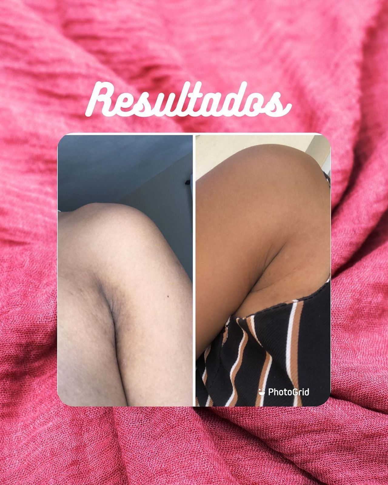 BeautyBleach