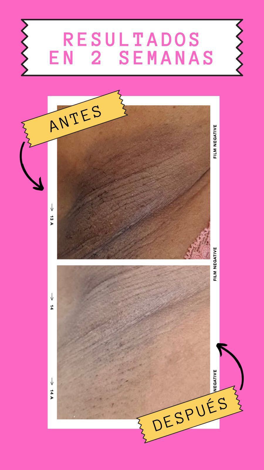 BeautyBleach