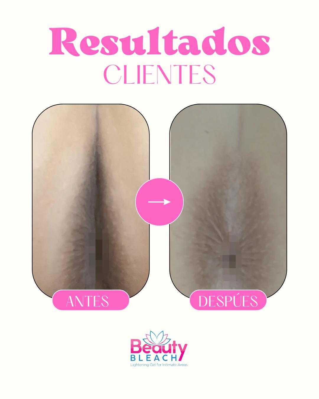 BeautyBleach